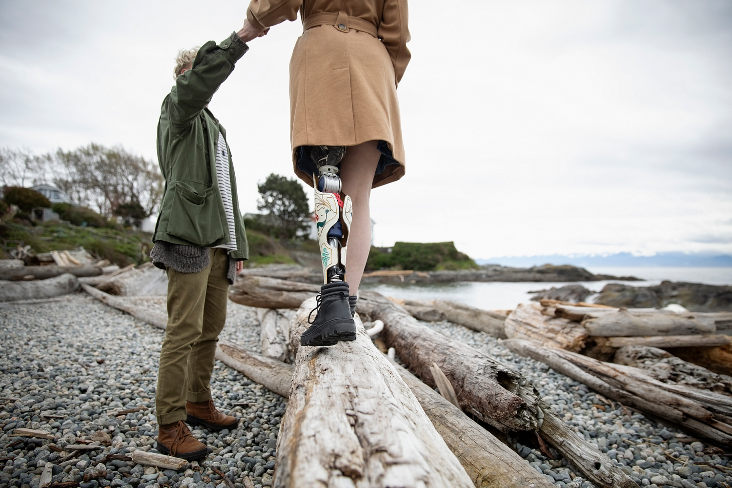 Протезы конечностей